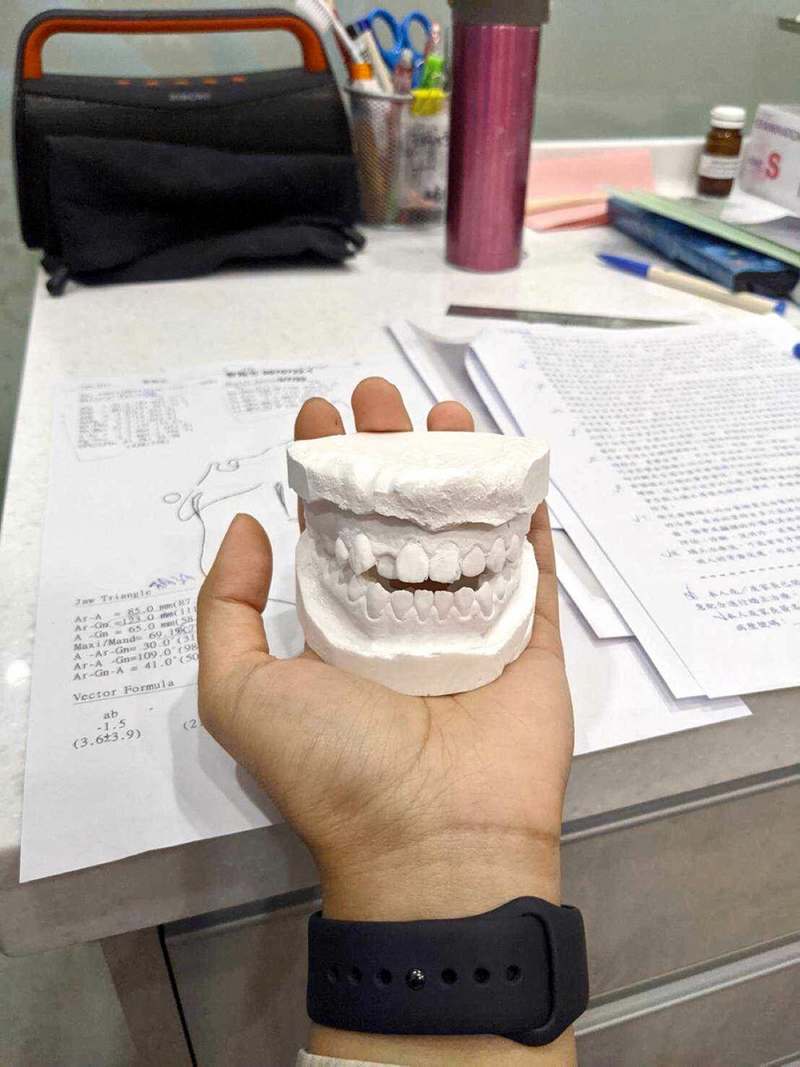 台南光美牙醫 牙套矯正全記錄